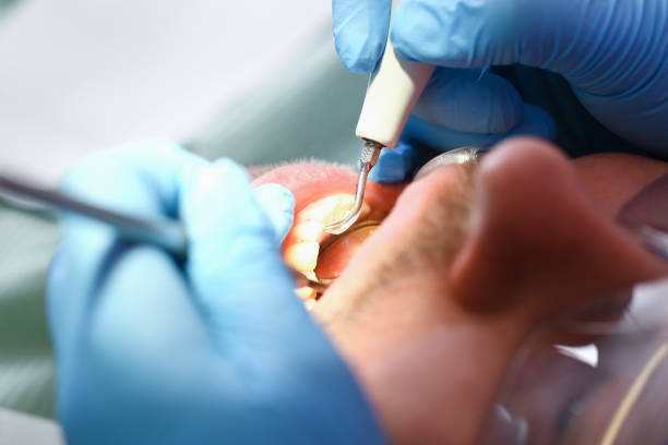 Best Emergency Pediatric Dentist  in Lake Forest, CA