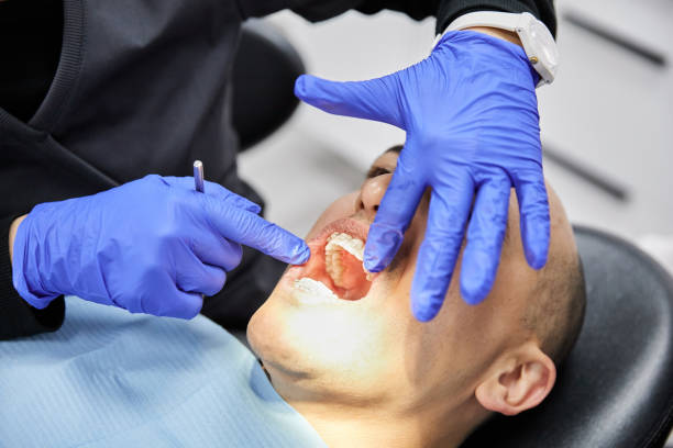 Best Broken Tooth Emergency  in Lake Forest, CA
