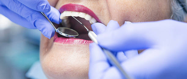 Best Emergency Dental Filling Replacement  in Lake Forest, CA